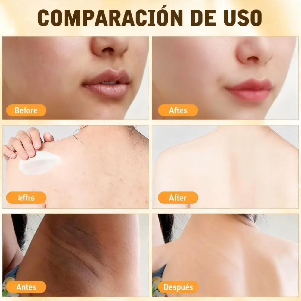Crema Reparadora Veneno De Abeja